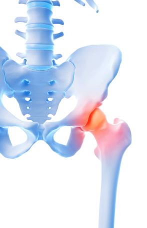 Osteoporose - Knochenbild